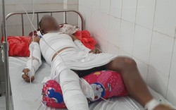 Nổ ghe lưới ghẹ làm 3 người bị thương nặng ở Cà Mau