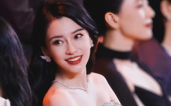 Bị phạt tiền vì "chê" Angelababy có hàm răng vẩu