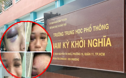 TP.HCM: Nam sinh bị đánh gãy xương trán nghi do mâu thuẫn tình cảm