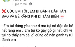 Vụ bé trai 14 tuổi bị nhóm thanh niên lạ mặt hành hung đến gãy răng: Luật sư nói gì?