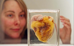 Người phụ nữ thấy trái tim mình trưng bày tại bảo tàng sau 16 năm