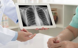 Nhập viện do tự ý điều trị viêm phổi, bác sĩ cảnh báo thói quen nhiều người thường mắc