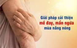 Hết mề đay, mẩn ngứa ngày hè – Giải pháp hiệu quả, tránh tái phát