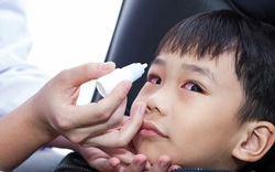 Đau mắt đỏ bùng phát, Sở Y tế TP.HCM khẳng định không khan hiếm thuốc điều trị