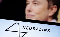 Elon Musk cấy chip vào não người thành công