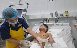 Đà Nẵng: Nhiều trường hợp đa chấn thương nặng nhập viện do pháo nổ