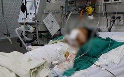 Hàng loạt trẻ bị tai nạn thương tâm do pháo dịp Tết