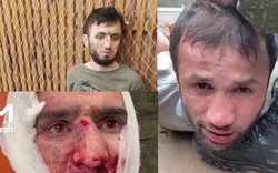 Khủng bố ở Moscow: Tất cả nghi phạm đều là công dân nước ngoài