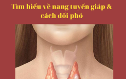 U nang tuyến giáp & cách cải thiện hiệu quả nhờ Ích Giáp Vương