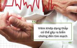 Bệnh viêm khớp dạng thấp: Mức độ nguy hiểm và giải pháp cải thiện từ Hoàng Thấp Linh