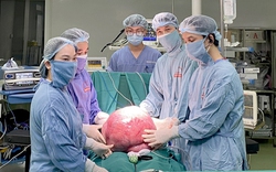 Kinh ngạc với khối u khổng lồ nặng 15kg trong bụng người phụ nữ