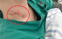 Vũ Hán: Người nhà chết do virus Corona, người đàn ông lao vào đánh, xé áo bác sĩ