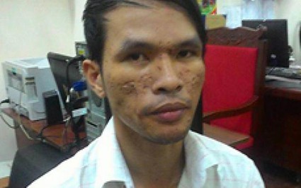 Kẻ hành hạ bé 3 tuổi bị Campuchia phạt 18 năm tù