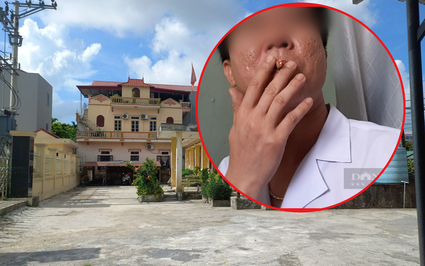 Công an thị xã Duy Tiên triệu tập Trạm trưởng Trạm Y tế phường Đồng Văn liên quan đến vụ trục lợi bảo hiểm