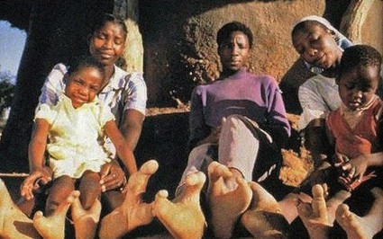 Clip: Bộ lạc châu Phi có bàn chân "đà điểu" cực độc đáo