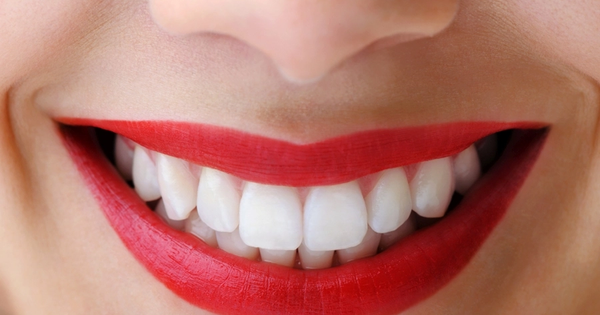 Những vấn đề răng chó có thể gây ra cho sức khỏe răng miệng?
