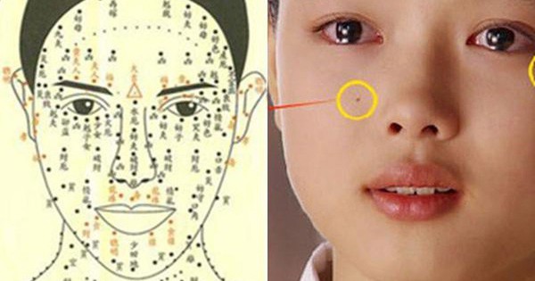 What is the meaning or symbolism of having Mụn ruồi gò má trái on the face?