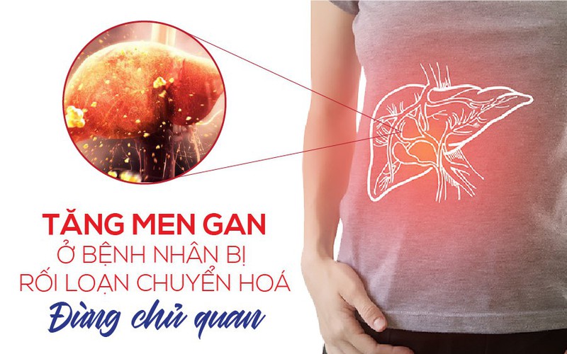 Tăng men gan ở bệnh nhân rối loạn chuyển hóa, đừng chủ quan!